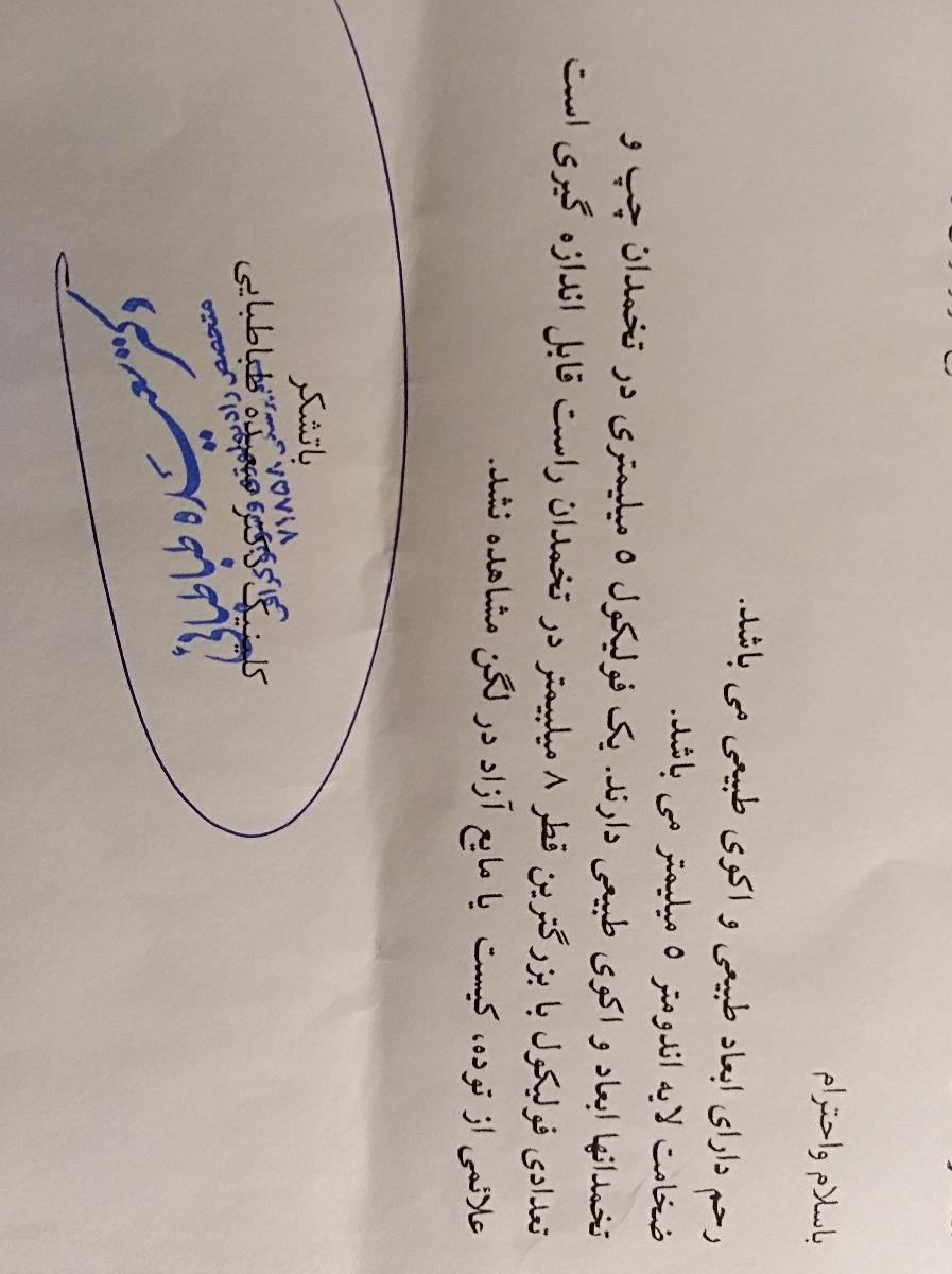 سیکل منظم یا نامنظم