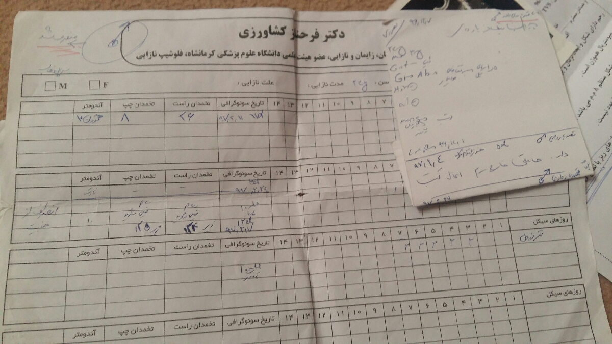 درمان تخمدان پلی کیستیک درمان تخمدان پلی کیستیک
