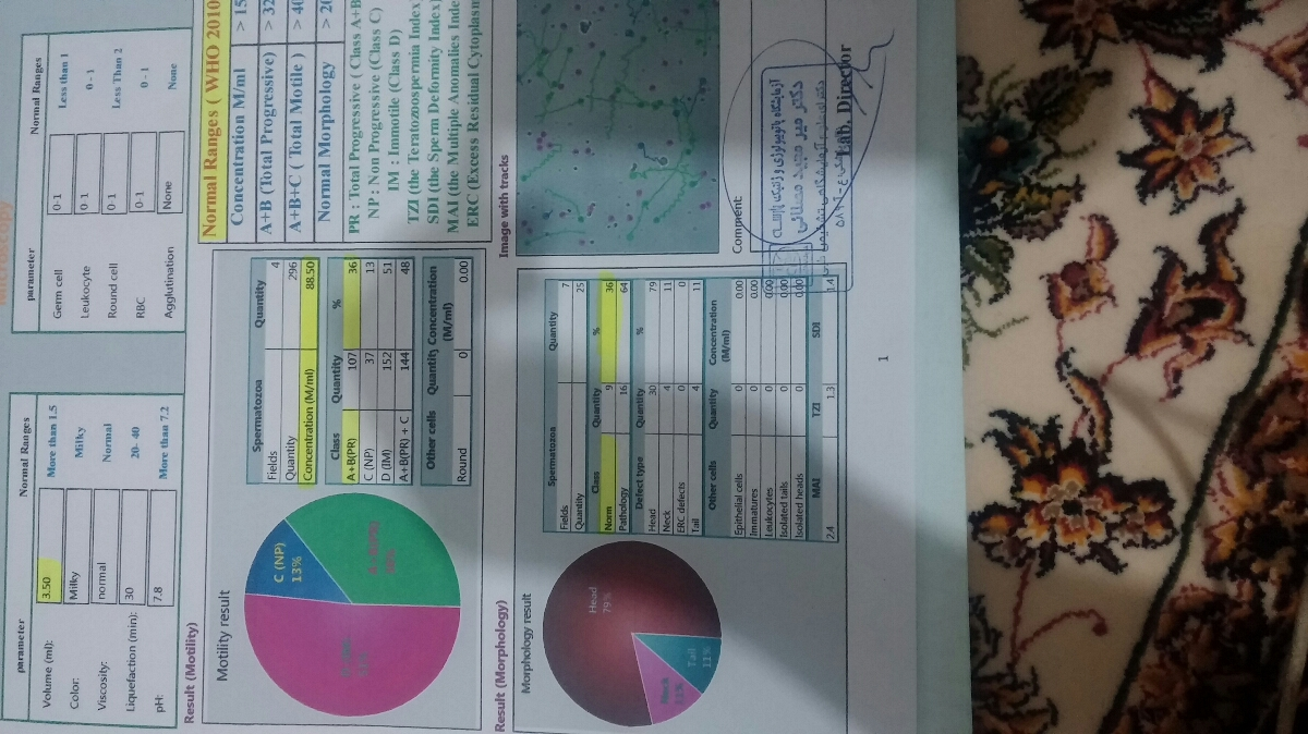 نتیجه انالیز اسپرم همسرم