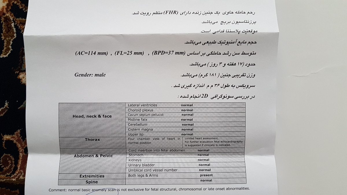 سونو آنومالی و بریچ بودن جنین طبیعی است؟ سونو آنومالی و بریچ بودن جنین طبیعی است؟