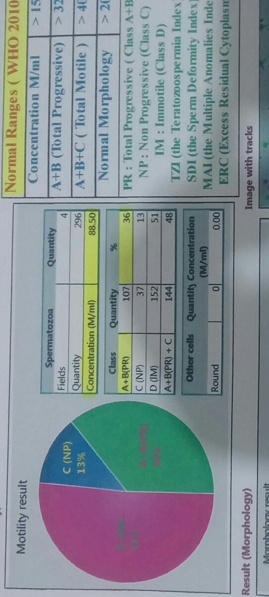 نتیجه انالیز اسپرم همسرم