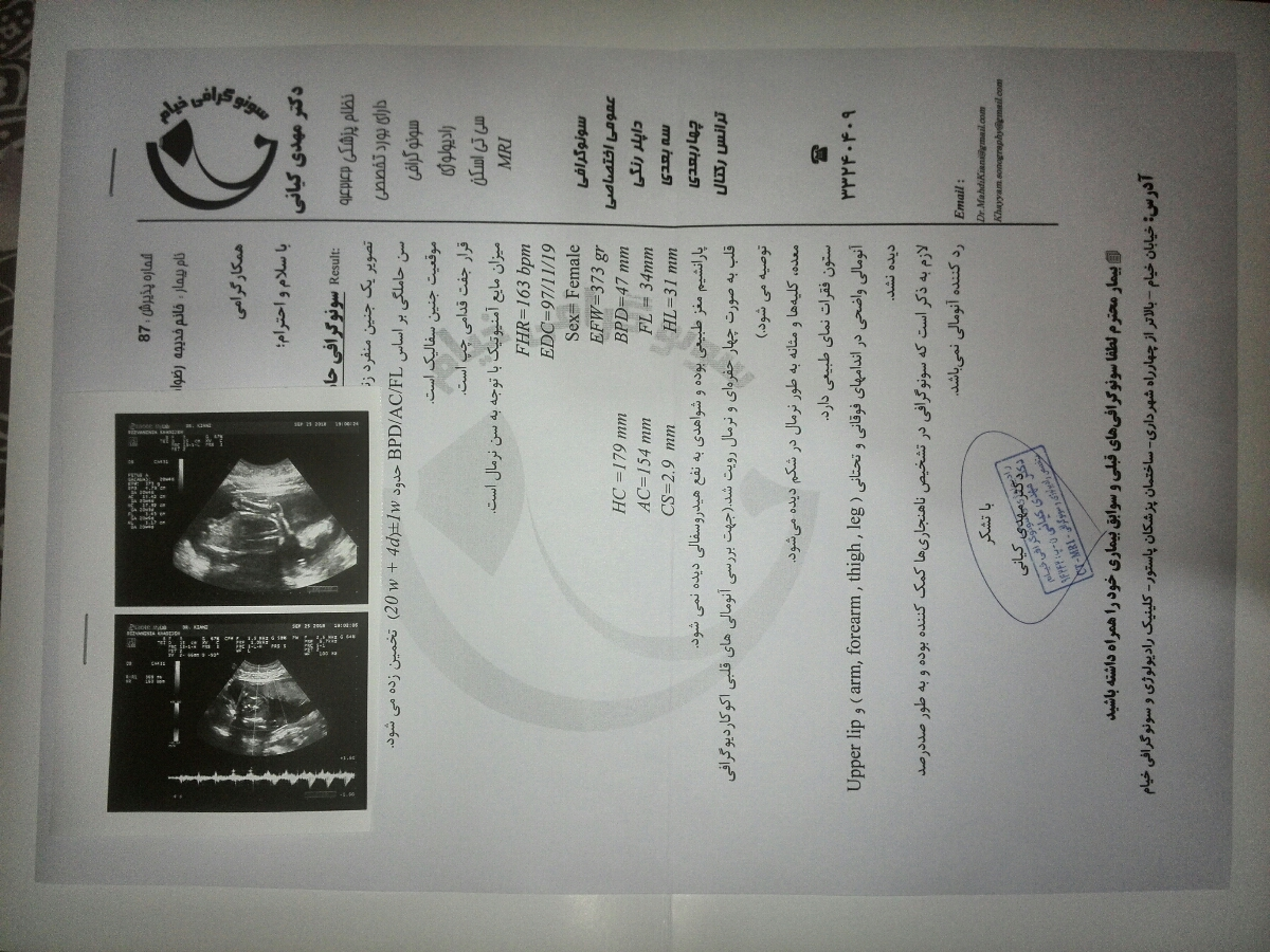 هفته نوزدهم بارداری هستم، هنوز حرکات جنین را احساس نکردم، چرا؟