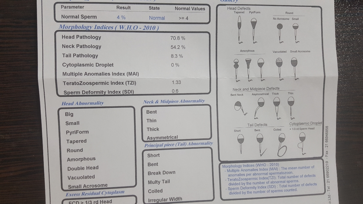 تفسیر آزمایش اسپرم .