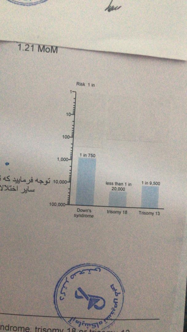 تفسیر سونو انی تی