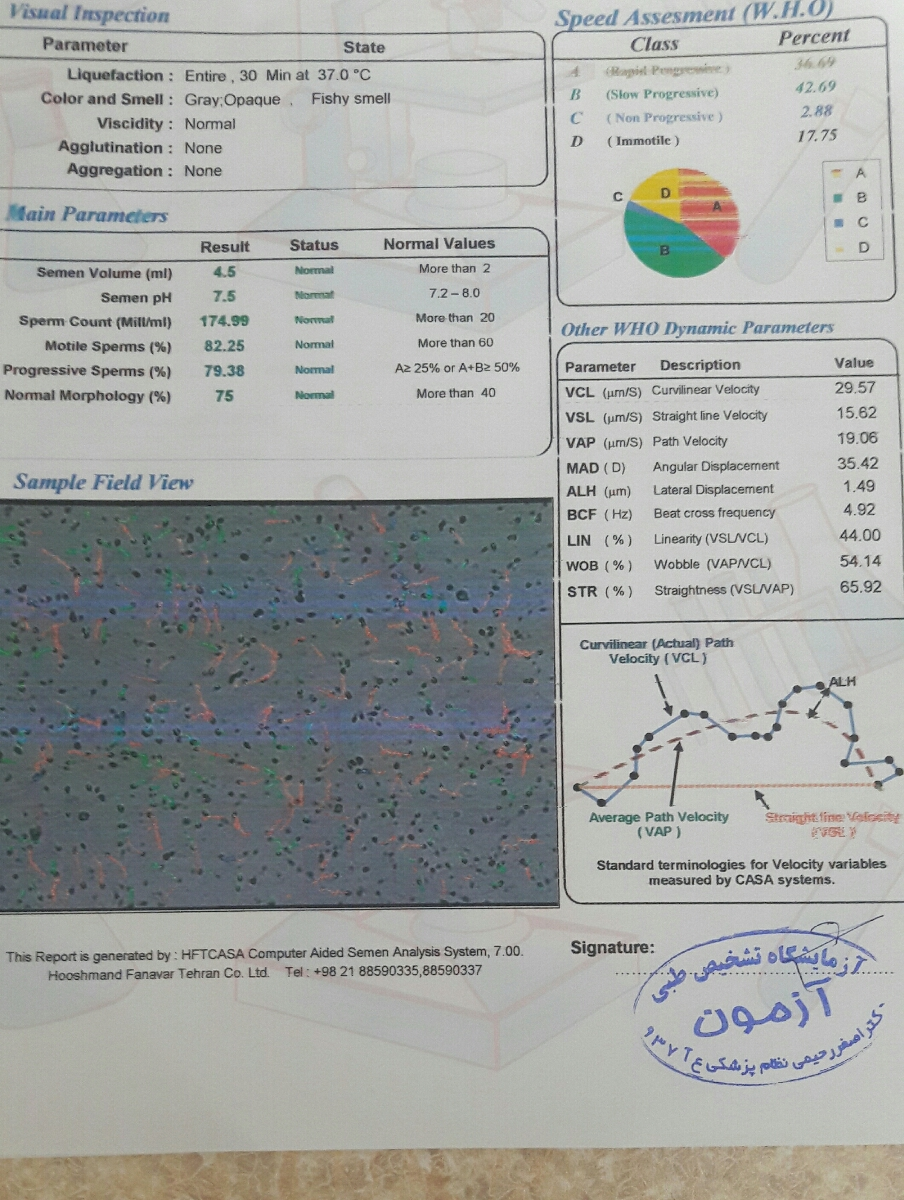 جواب آزمایش اسپرم همسرم