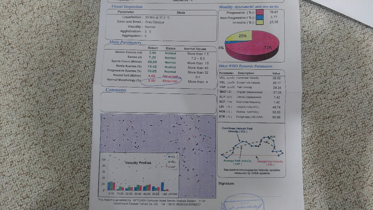 جواب آزمایش اسپرم همسرم