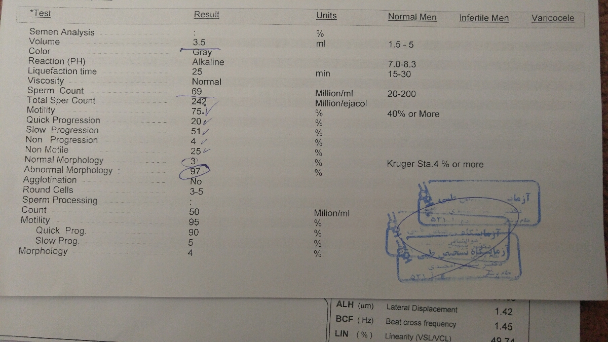 جواب آزمایش اسپرم همسرم