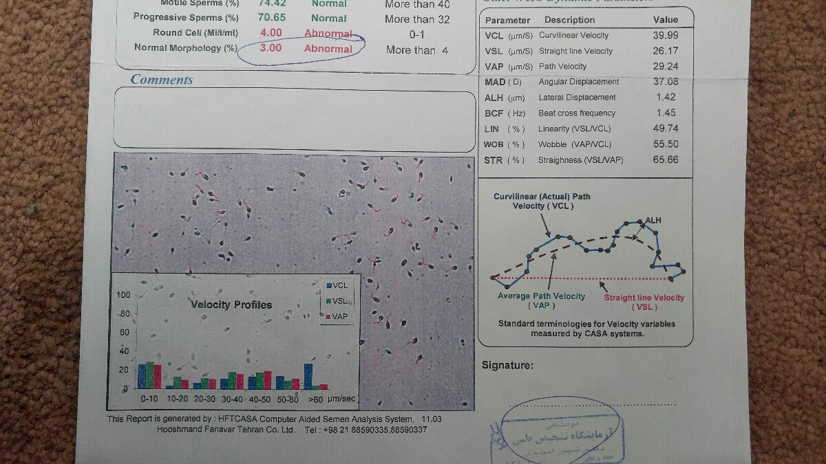 جواب آزمایش اسپرم همسرم