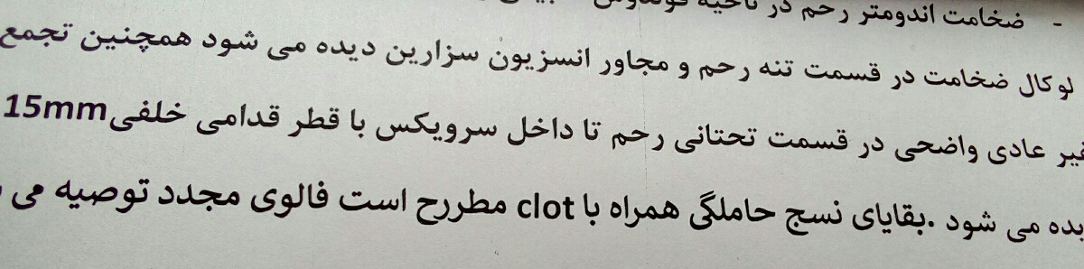 سونو بعد از سقط