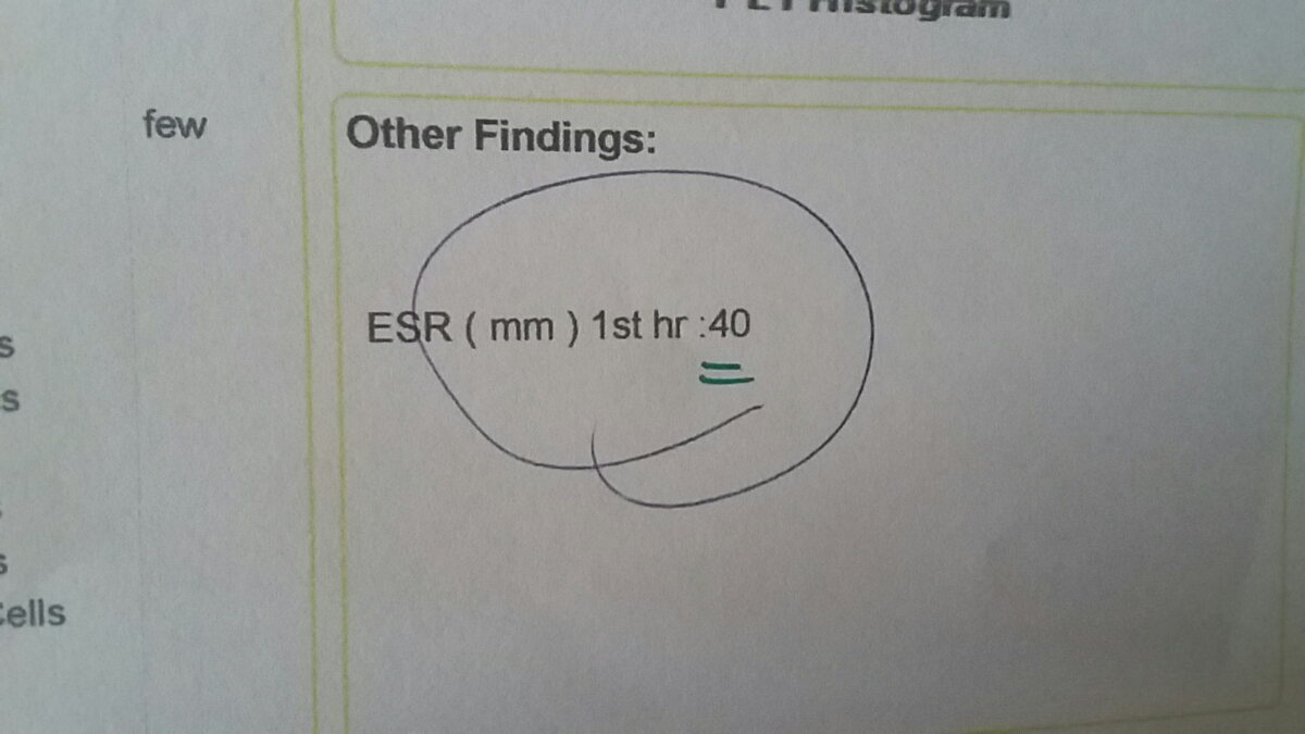متورم شدن یک سینه