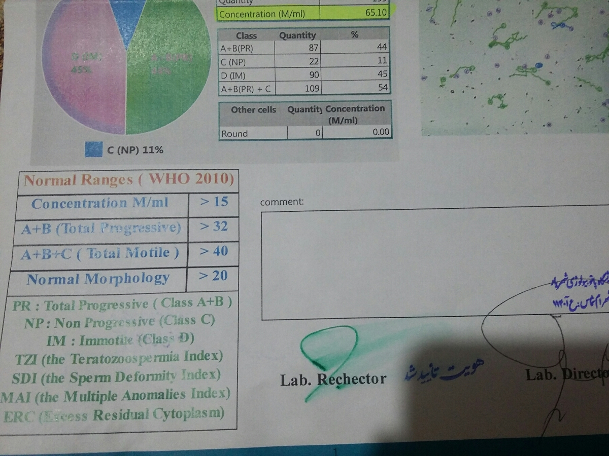 تفسیر آزمایش اسپرم همسرم