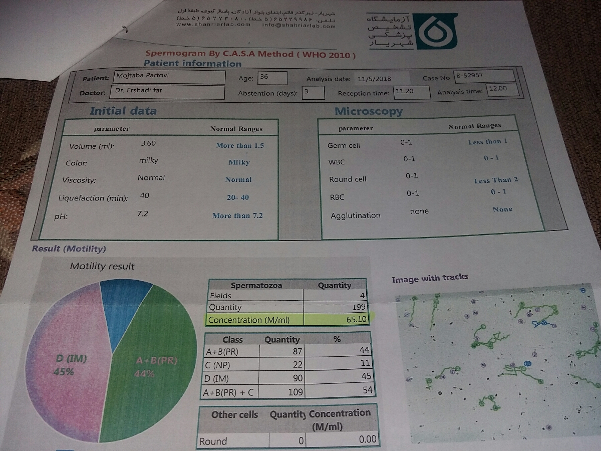 تفسیر آزمایش اسپرم همسرم