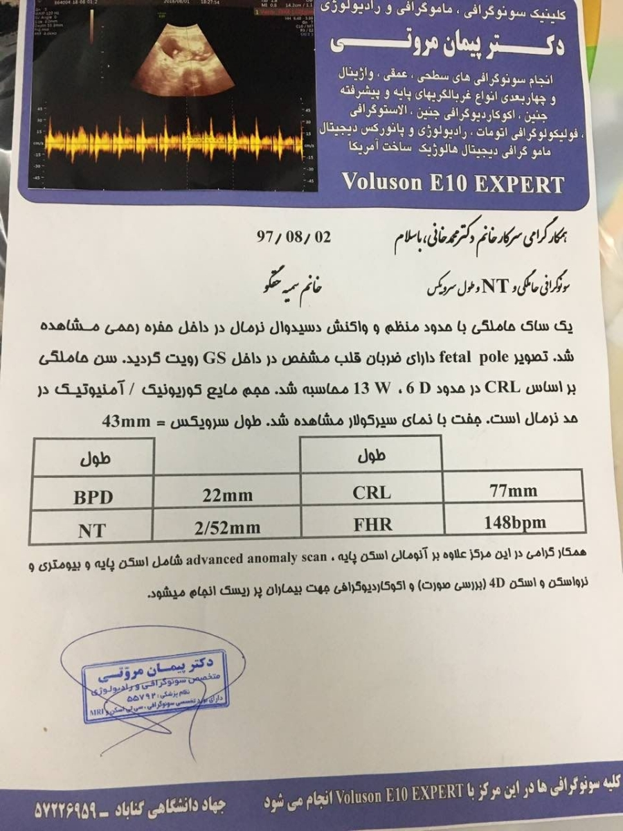 آزمایش غربالگری مرحله اول