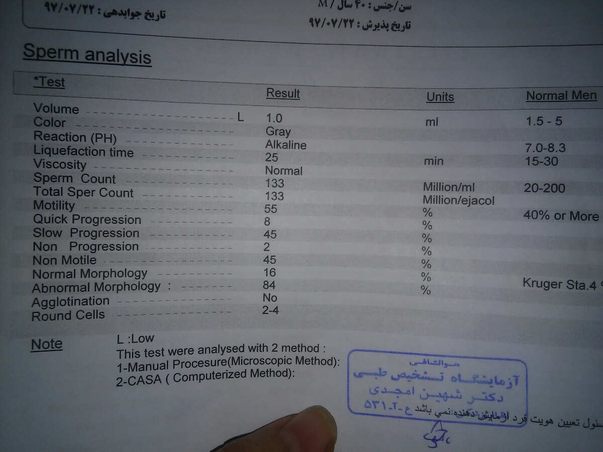 گرفتن سونو در روز 5 و14 پریودی ومصرف دارو گرفتن سونو در روز 5 و14 پریودی ومصرف دارو