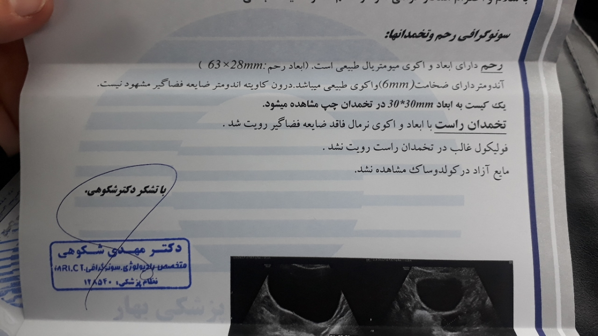 ماه قبل کیست نداشتم این‌سونو امروزمه