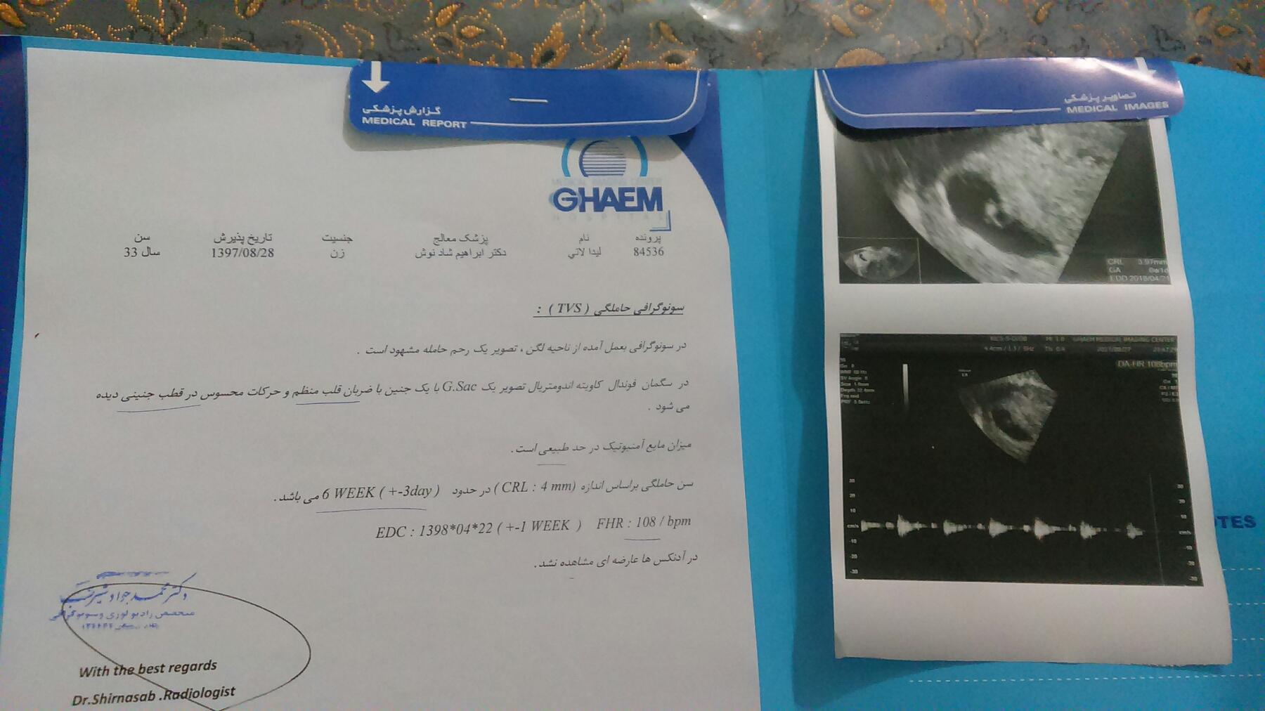 درد زیر شکم در هفته هفتم بارداری درد زیر شکم در هفته هفتم بارداری