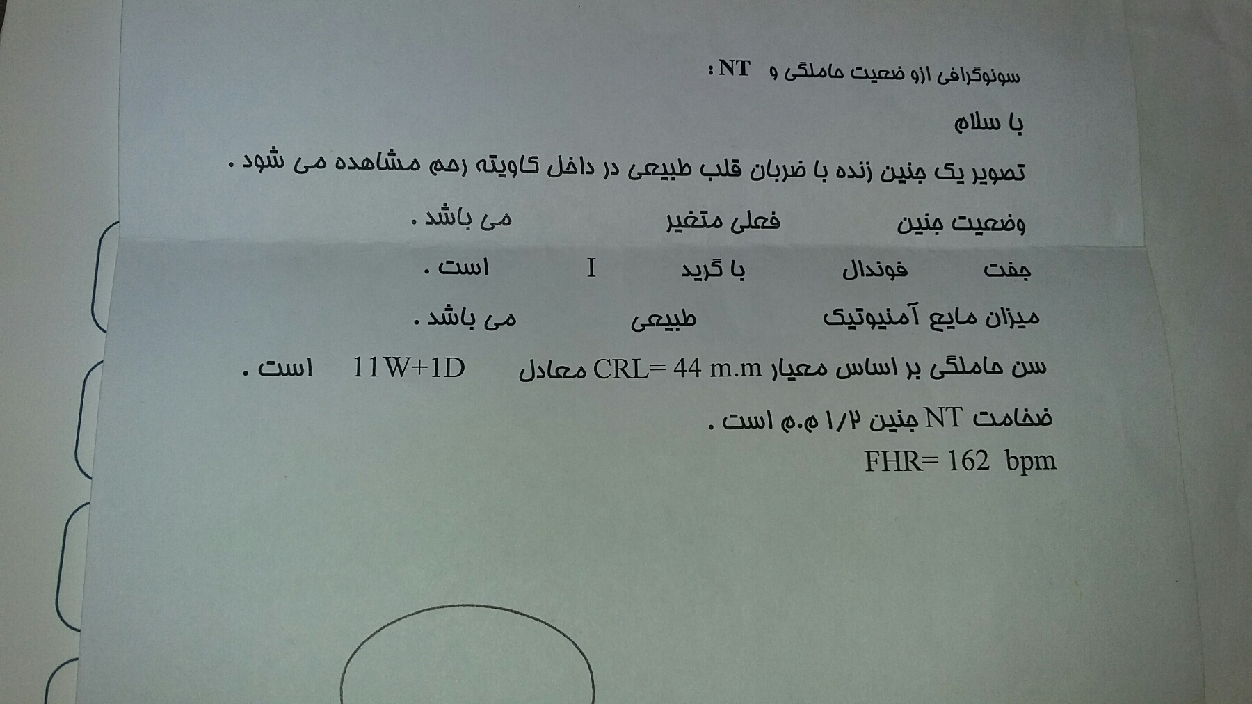 اختلاف سن جنین در سونو آنومالی