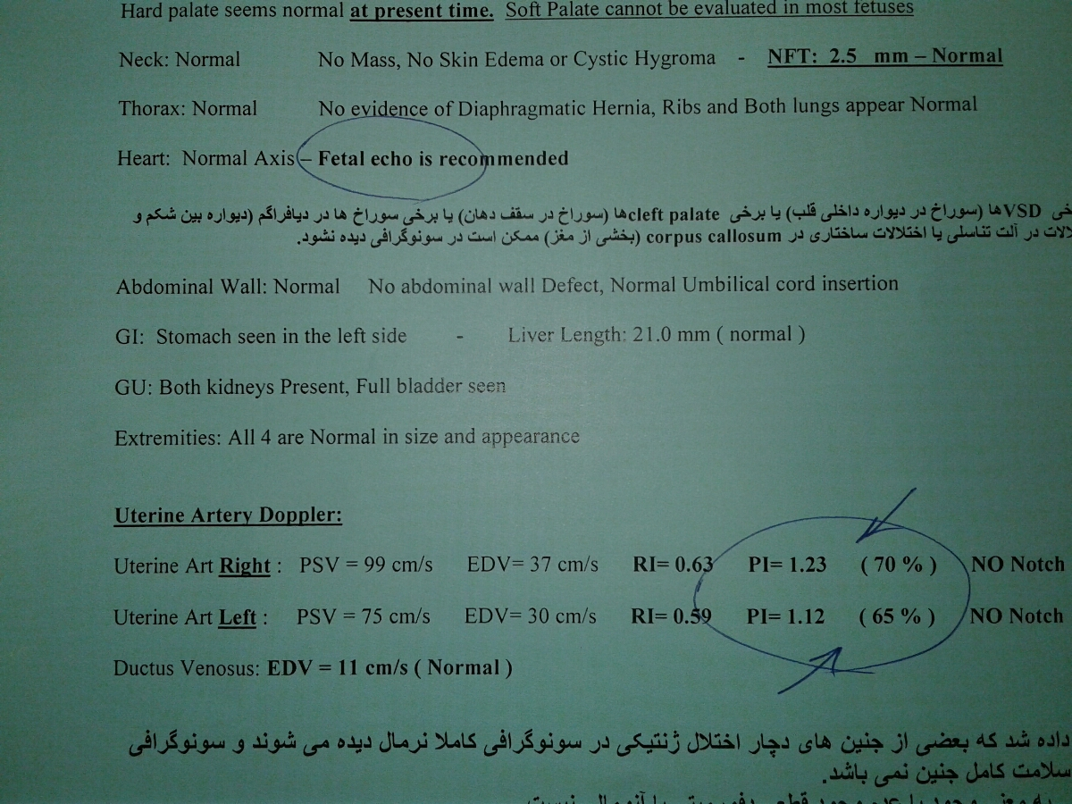 تفسیر سونو آنومالی جنین