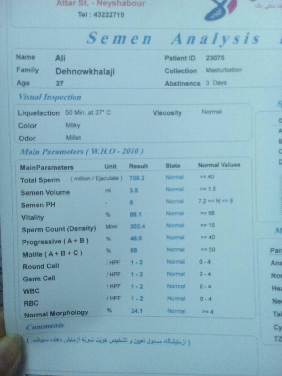 تفسیر ازمایش اسپرم