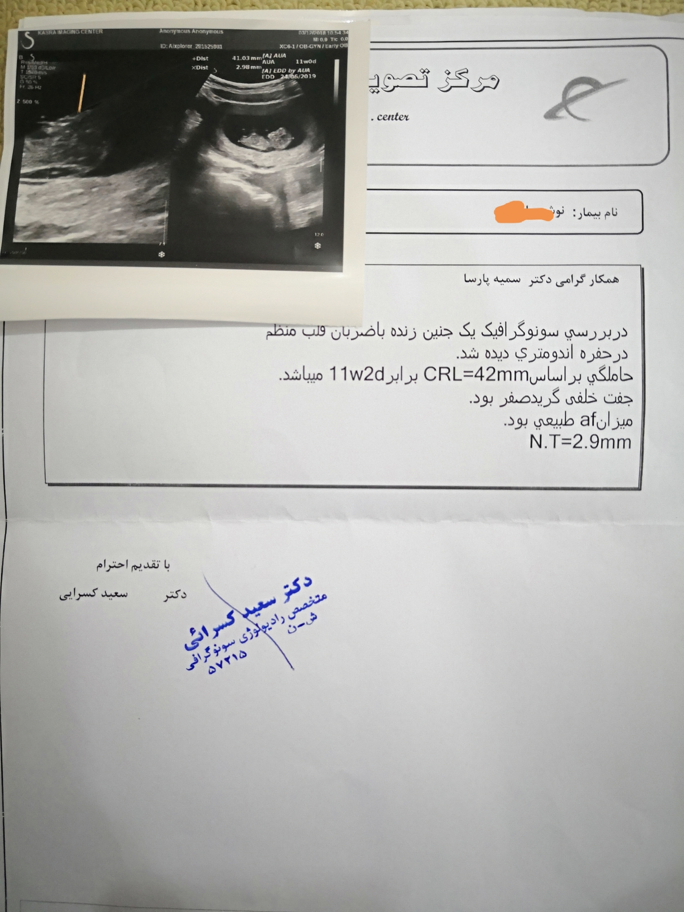 سونو هفته دوازدهم