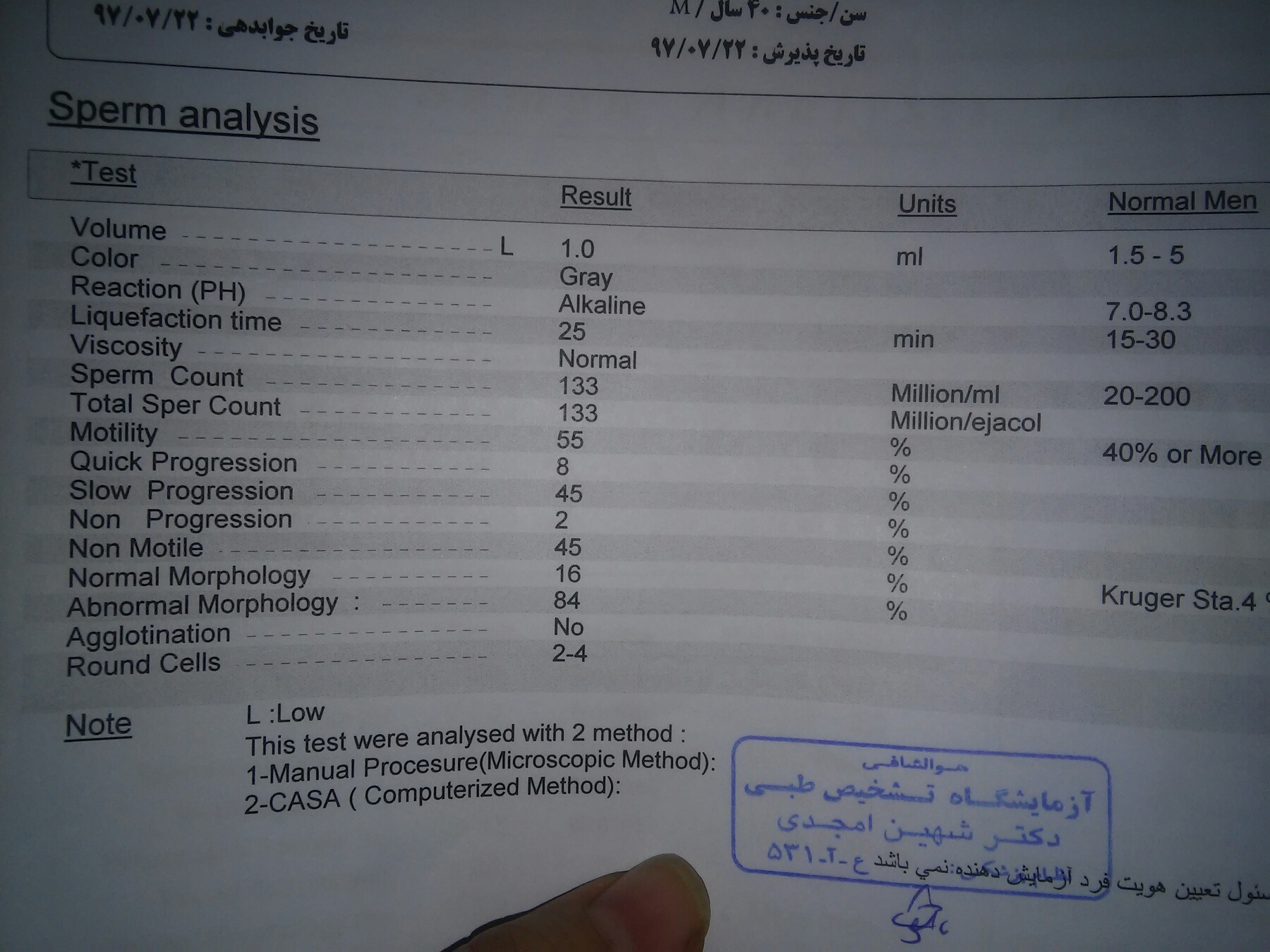 واریکوسل وصرف عرق کاسنی