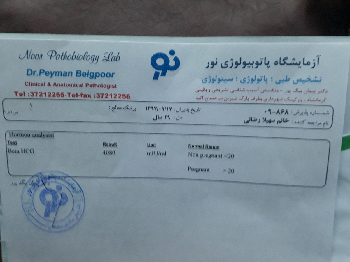 تست بی بی چک و نشان دادن بارداری