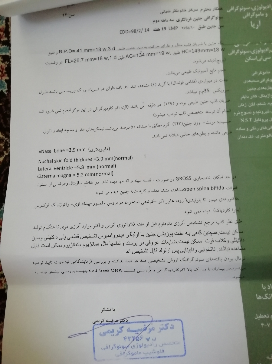 سونو آنامالی و استخوان بینی سونو آنامالی و استخوان بینی