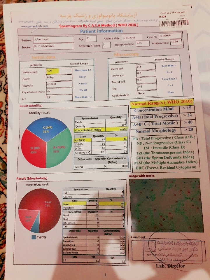 تفسیر ازمایش اسپرم همسرم