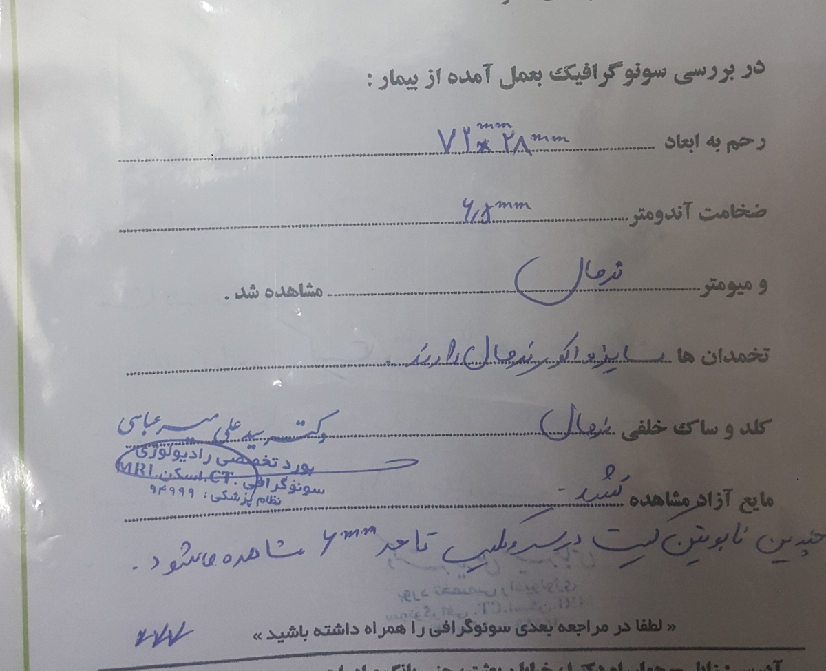 تفسیر سونوگرافی تنبلی تخمدان تفسیر سونوگرافی تنبلی تخمدان