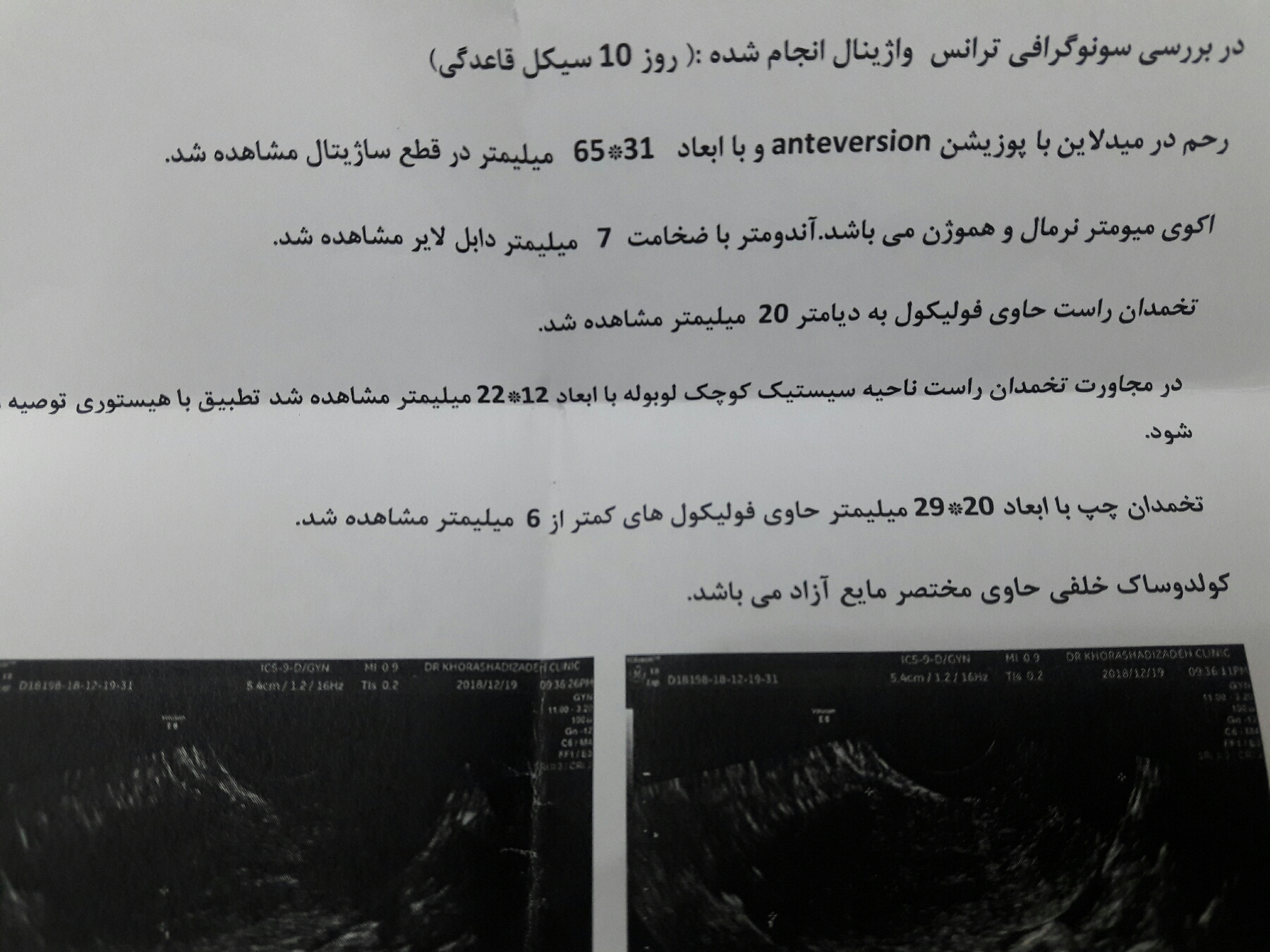 سونوگرافی روز ۱۰ سیکل