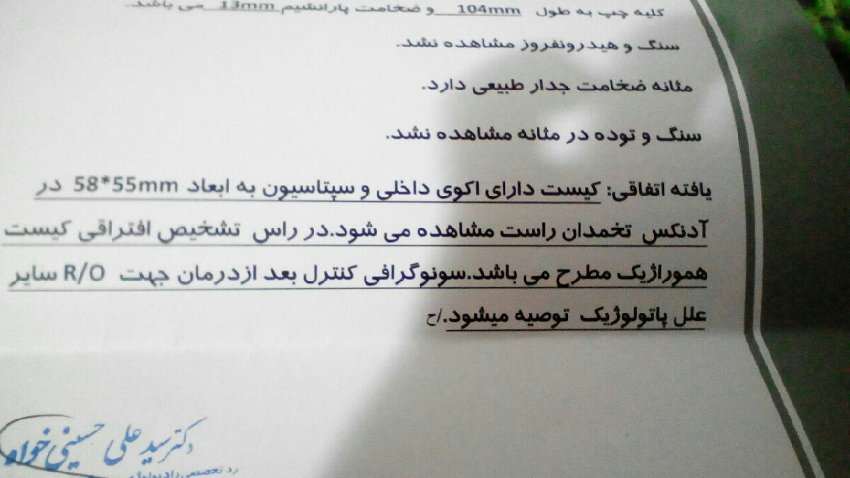 کیست درون لوله فالوپ