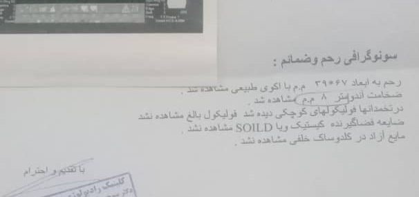 تفسیر سونو فولیکول روز ۱۱ پریود