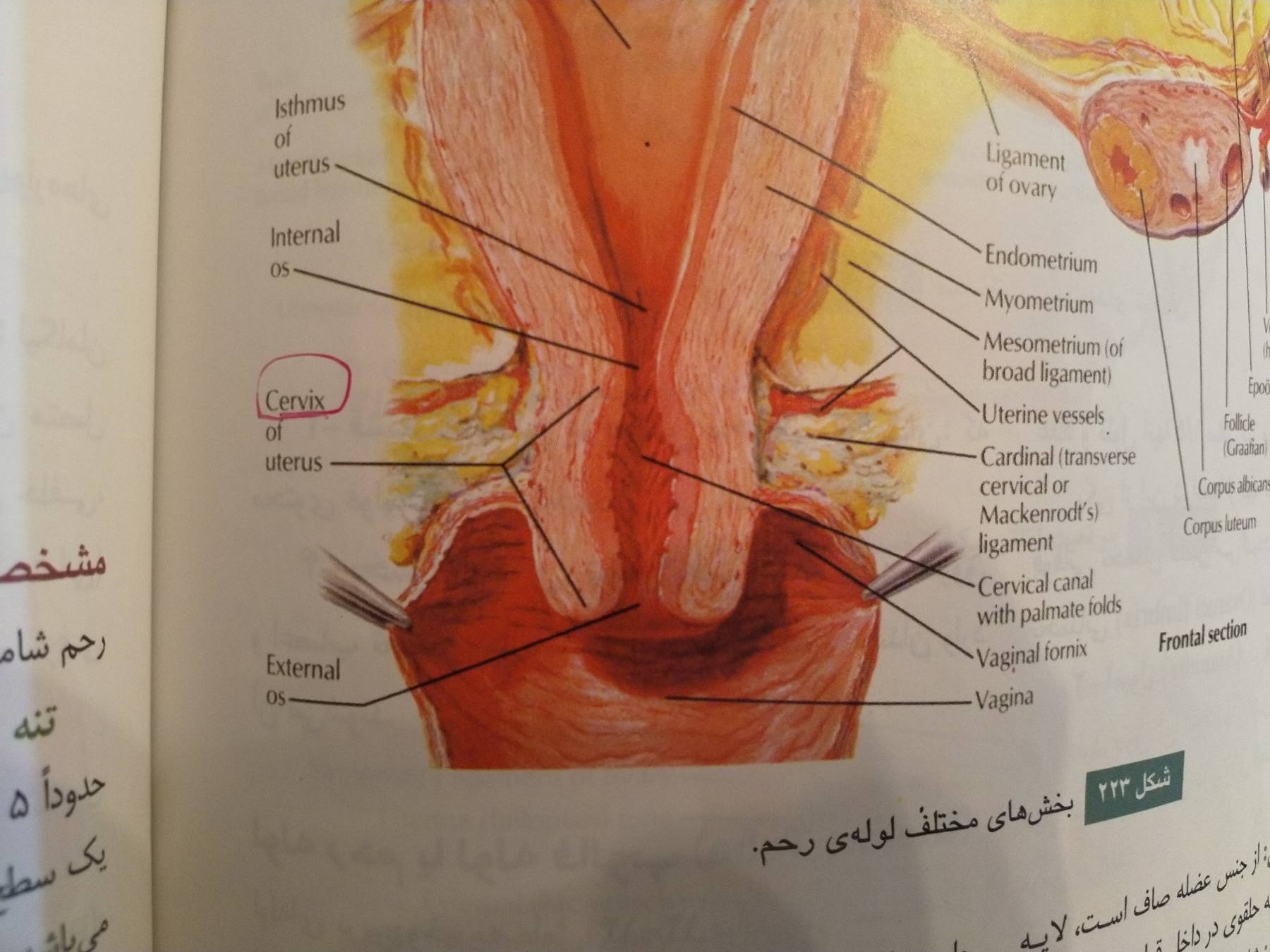 تفسیر سونو ان تی و ان بی