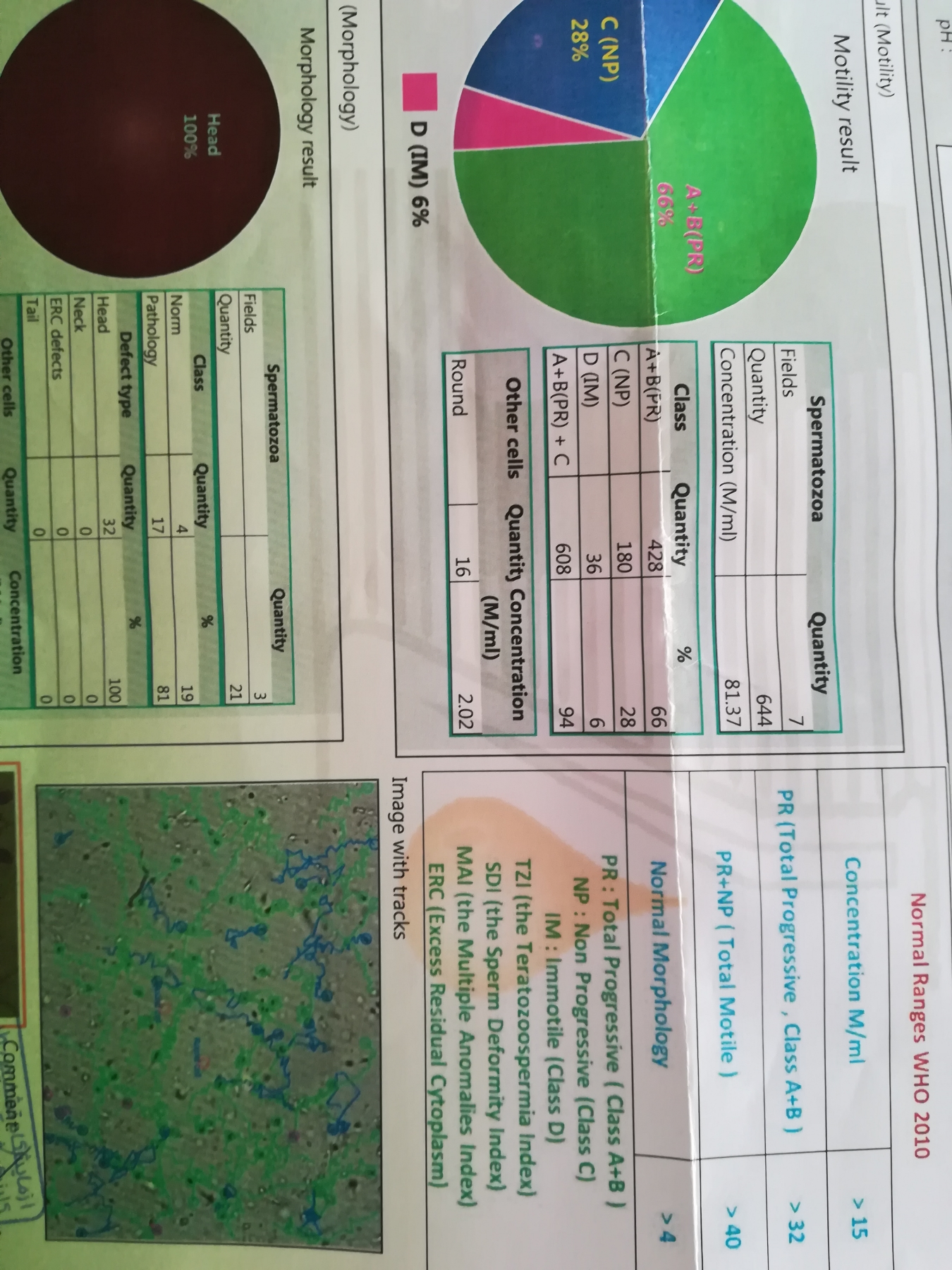 تفسیر آزمایش اسپرم و آزمایش ca 125