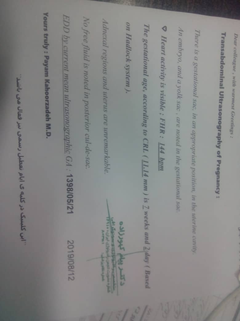 تفاوت سونو با اوما