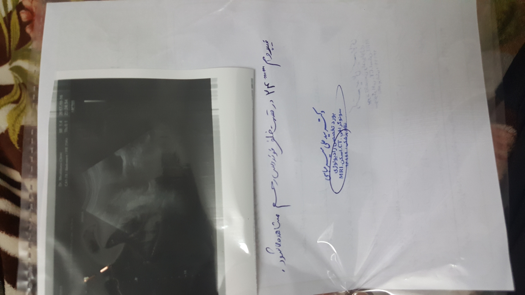 تفسیر سونوگرافی و نیاز به کورتاژ