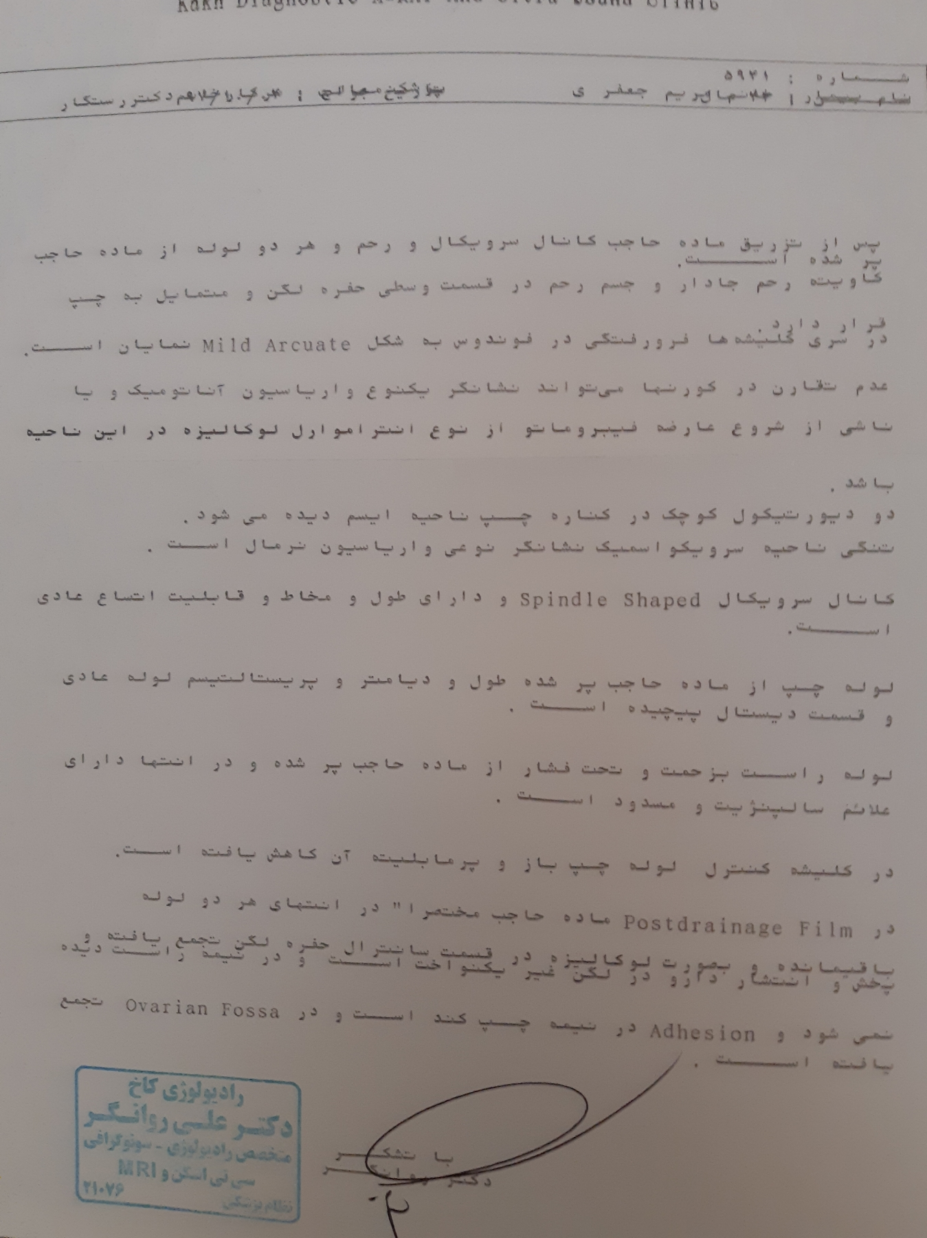 چسبندگی لوله رحمی و ivf چسبندگی لوله رحمی و ivf