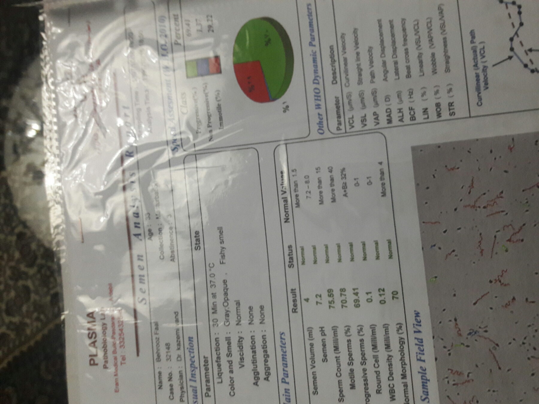 آزمایش اسپرم همسرم رو میشه ببینین