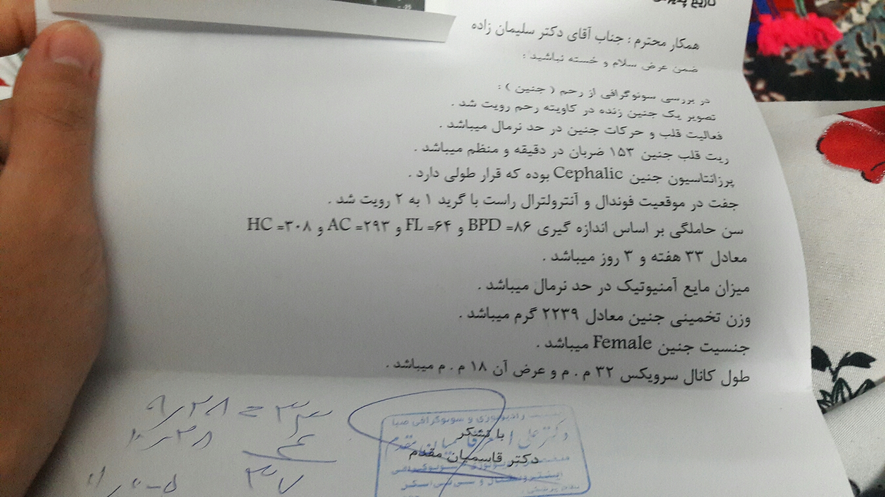 جفت قدامی و سزارین