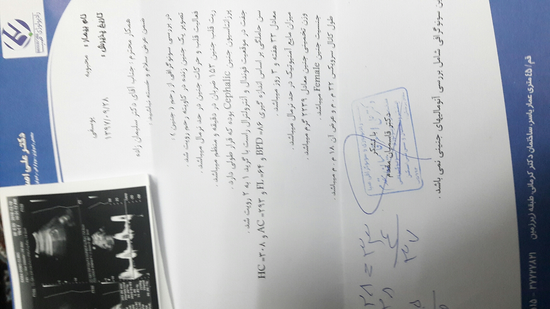جفت قدامی و سزارین