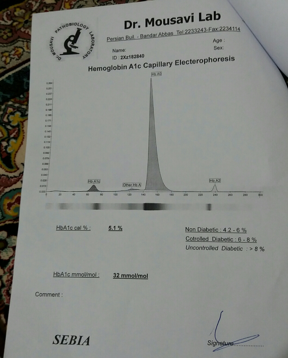 تفسیر ازمایش قبل از بارداری؟