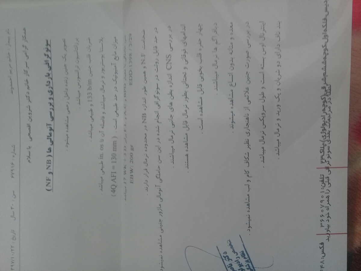 سونوگرافی غربالگری دوم ممنون