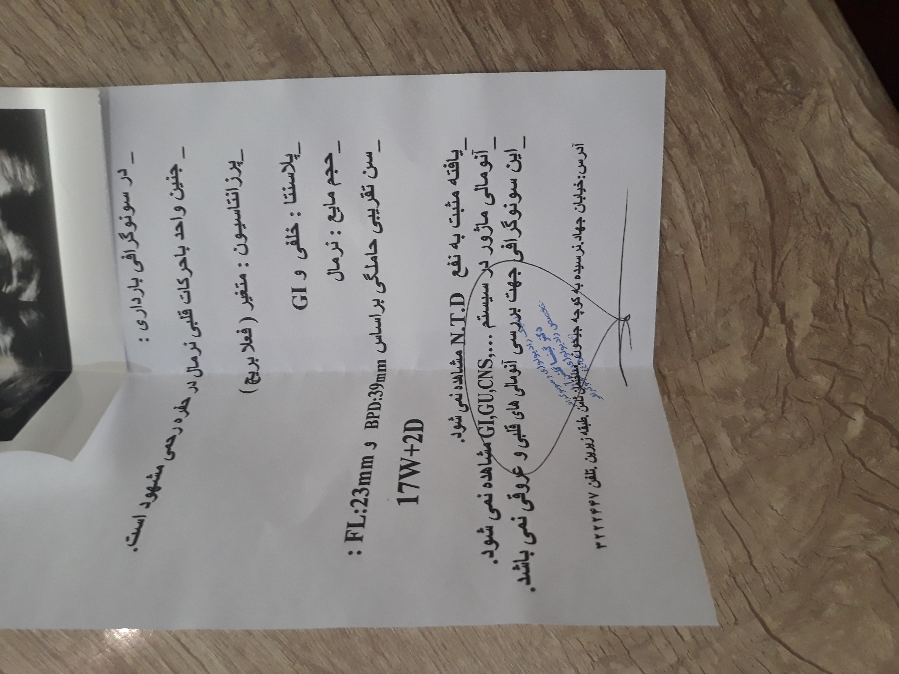 سونو انومالی و غربالگری مرحله دوم
