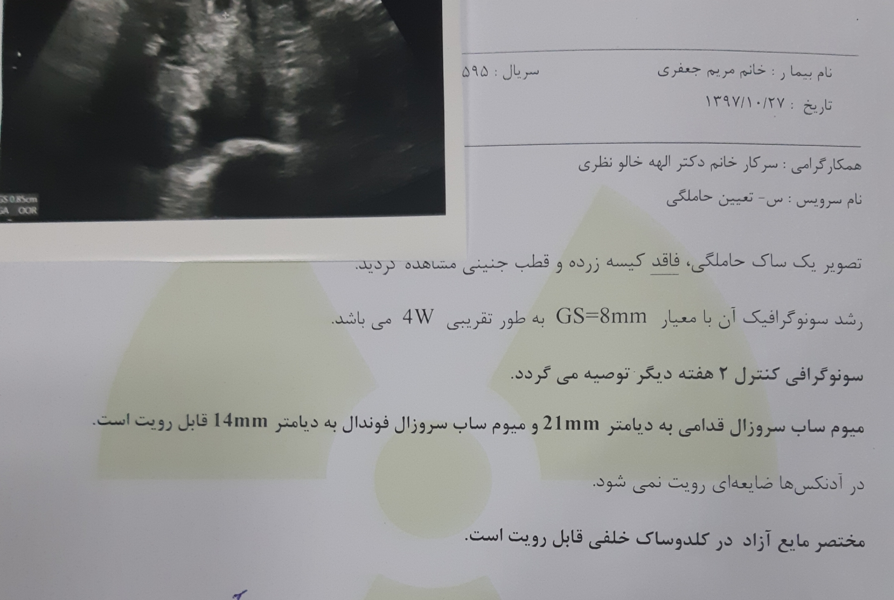 تفسیر جواب سونو در ۴ هفتگی