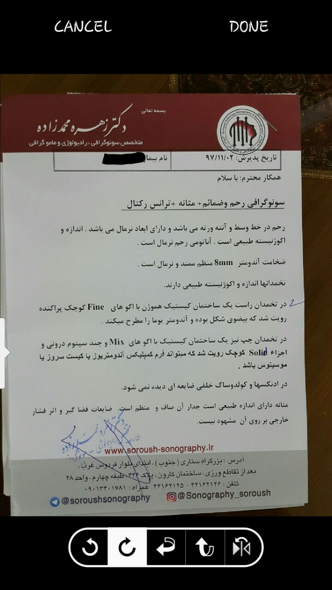 کیست آندومتریوز و ناباروری کیست آندومتریوز و ناباروری