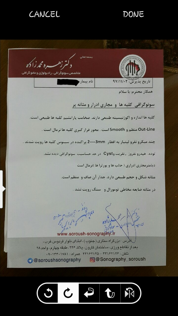 کیست آندومتریوز و ناباروری کیست آندومتریوز و ناباروری