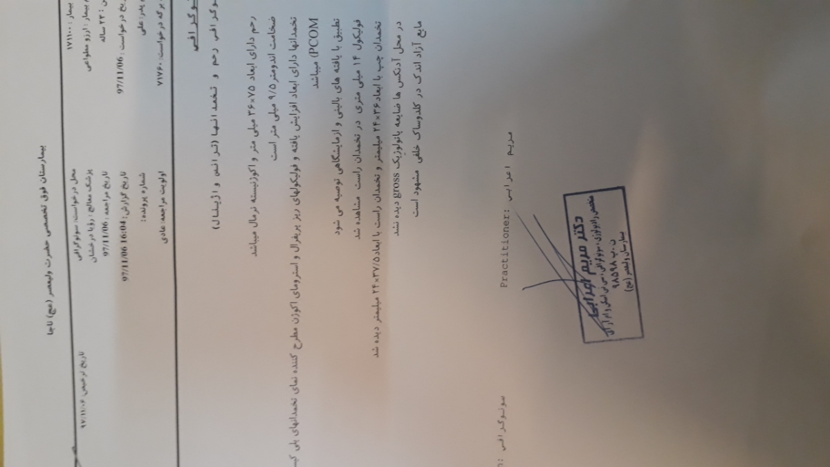 کیست در تخمدان راست
