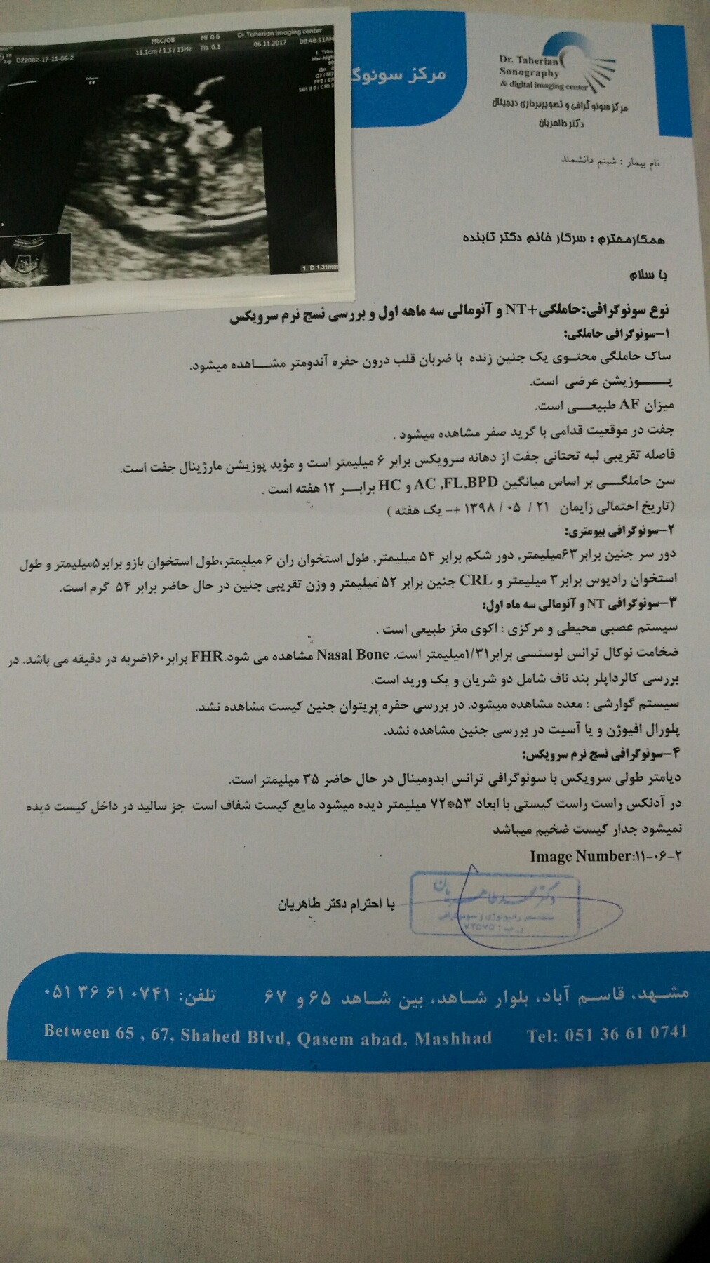 تفسیر سونو و غربالگری مرحله اول