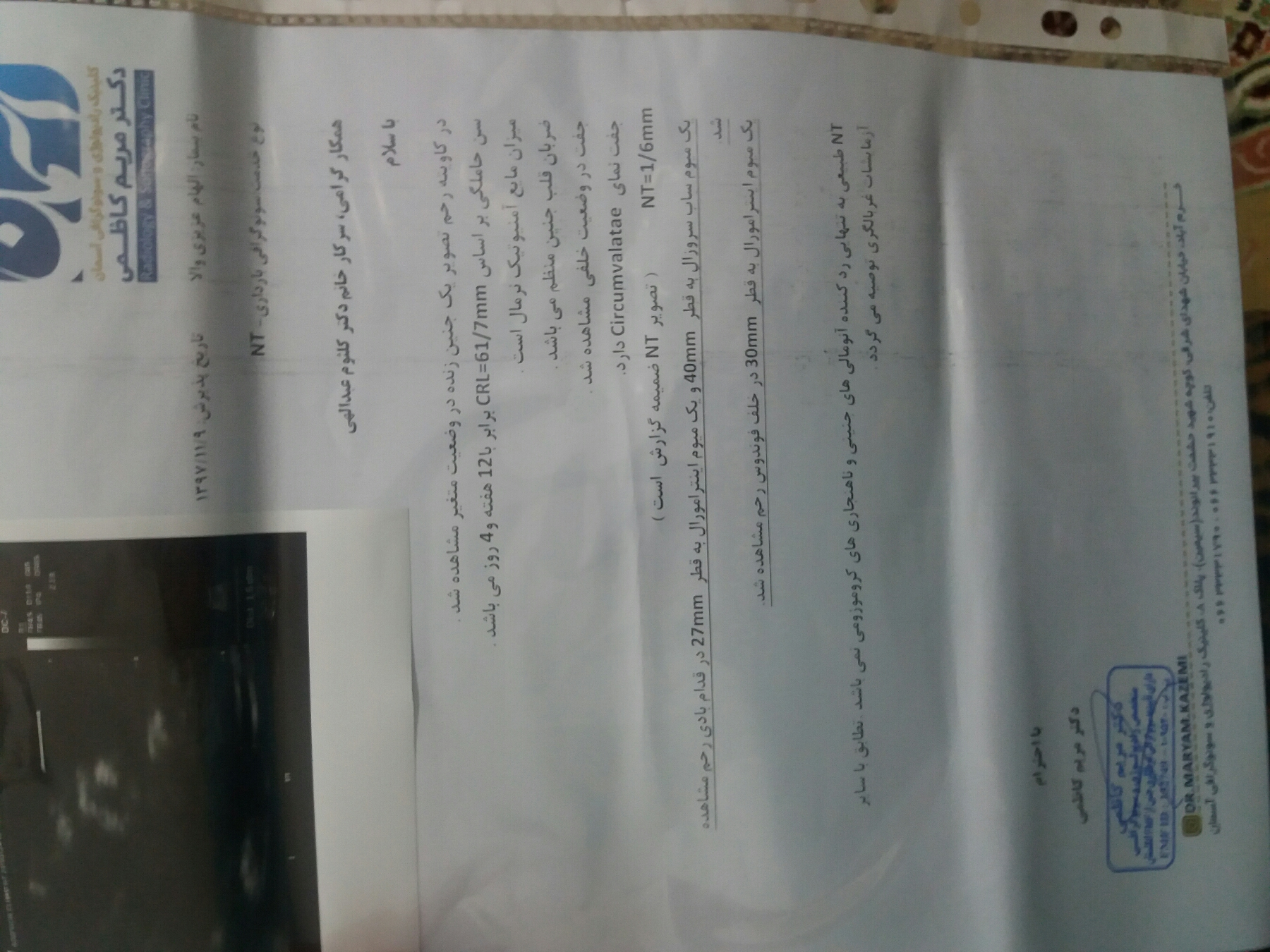 نتیجه سونوگرافی NT لطفا دکتر حتما پاسخ دهند نتیجه سونوگرافی NT لطفا دکتر حتما پاسخ دهند
