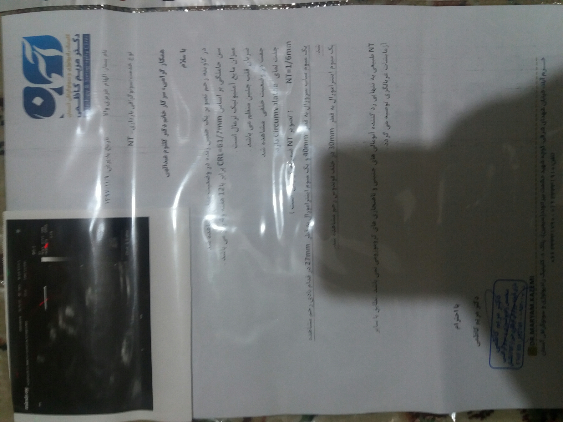 نتیجه سونوگرافی NT لطفا دکتر حتما پاسخ دهند نتیجه سونوگرافی NT لطفا دکتر حتما پاسخ دهند